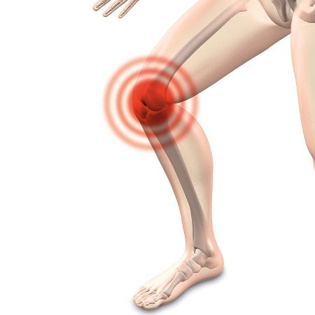 La rodilla del corredor - Causas, síntomas y tratamiento
