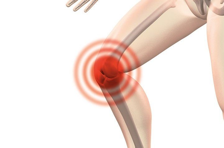 4 ejercicios para mejorar tu salud con artrosis de rodilla